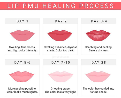 Lip Healing